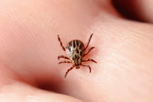 Tick Removal